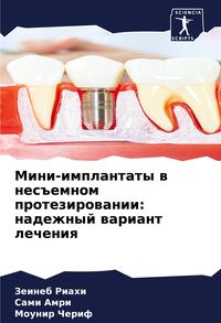 Produktbild: Mini-implantaty w nes#emnom protezirowanii: nadezhnyj wariant lecheniq