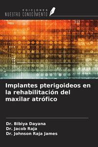 Produktbild: Implantes pterigoideos en la rehabilitaci&oacute;n del maxilar atr&oacute;fico