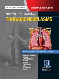 Produktbild: Specialty Imaging: Thoracic Neoplasms E-Book