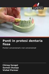 Produktbild: Ponti in protesi dentaria fissa