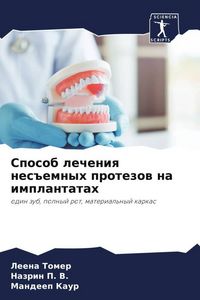 Produktbild: Sposob lecheniq nes#emnyh protezow na implantatah