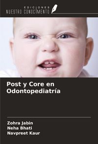 Produktbild: Post y Core en Odontopediatr&iacute;a