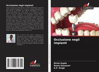 Produktbild: Occlusione negli impianti