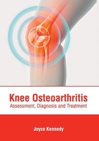 Produktbild: Knee Osteoarthritis: Assessment, Diagnosis and Treatment