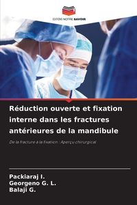 Produktbild: R&eacute;duction ouverte et fixation interne dans les fractures ant&eacute;rieures de la mandibule