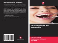 Produktbild: Mini-implantes em ortodontia