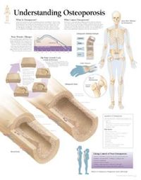 Produktbild: Understanding Osteoporosis Cha