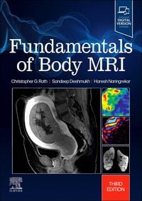 Produktbild: Fundamentals of Body MRI