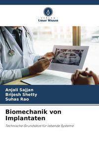 Produktbild: Biomechanik von Implantaten
