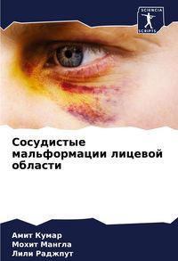 Produktbild: Sosudistye mal'formacii licewoj oblasti