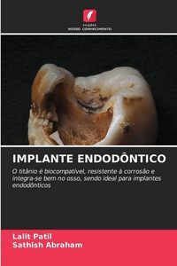 Produktbild: Implante Endod&ocirc;ntico