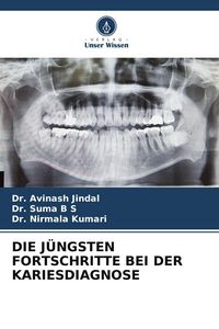 Produktbild: Die J&uuml;ngsten Fortschritte bei der Kariesdiagnose