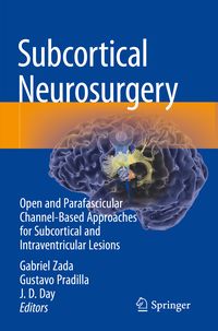 Produktbild: Subcortical Neurosurgery