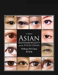 Produktbild: Asian Blepharoplasty and the Eyelid Crease E-Book