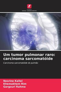 Produktbild: Um tumor pulmonar raro: carcinoma sarcomat&oacute;ide
