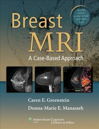 Produktbild: Breast Mri