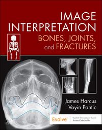 Produktbild: Image Interpretation: Bones, Joints, and Fractures - E-Book
