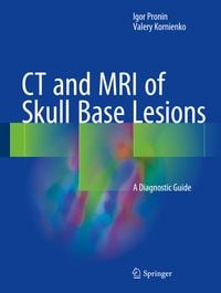 Produktbild: CT and MRI of Skull Base Lesions