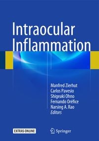 Produktbild: Intraocular Inflammation