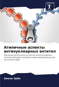 Produktbild: Atipichnye aspekty antinuklearnyh antitel