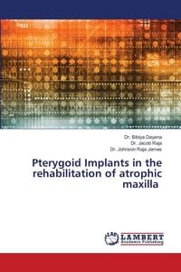Produktbild: Pterygoid Implants in the rehabilitation of atrophic maxilla