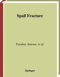 Produktbild: Spall Fracture