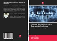 Produktbild: Falhas e Gerenciamento de Doen&ccedil;as de Implantes