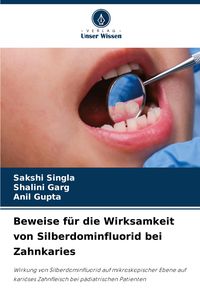 Produktbild: Beweise f&uuml;r die Wirksamkeit von Silberdominfluorid bei Zahnkaries