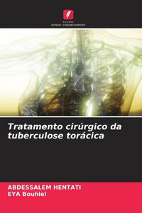 Produktbild: Tratamento cir&uacute;rgico da tuberculose tor&aacute;cica