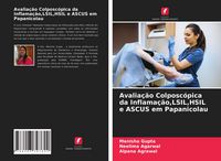 Produktbild: Avalia&ccedil;&atilde;o Colposc&oacute;pica da Inflama&ccedil;&atilde;o,LSIL,HSIL e ASCUS em Papanicolau