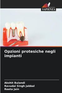 Produktbild: Opzioni protesiche negli impianti