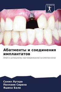 Produktbild: Abatmenty i soedineniq implantatow