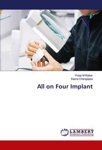 Produktbild: All on Four Implant