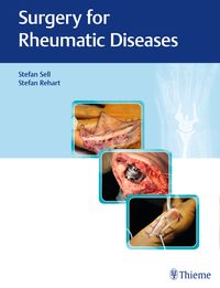 Produktbild: Surgery for Rheumatic Diseases