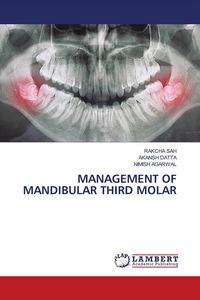 Produktbild: Management Of Mandibular Third Molar