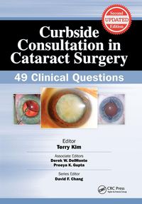 Produktbild: Curbside Consultation in Cataract Surgery