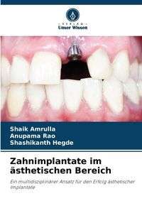 Produktbild: Zahnimplantate im &auml;sthetischen Bereich