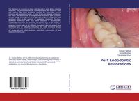 Produktbild: Post Endodontic Restorations