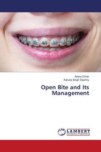 Produktbild: Open Bite and Its Management