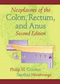Produktbild: Gordon, P: Neoplasms of the Colon, Rectum, and Anus