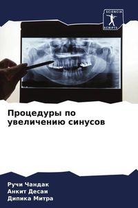 Produktbild: Procedury po uwelicheni&uuml; sinusow