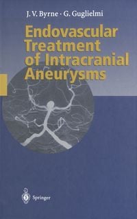 Produktbild: Endovascular Treatment of Intracranial Aneurysms