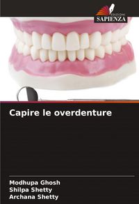 Produktbild: Capire le overdenture