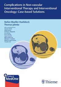 Produktbild: Complications in Non-vascular Interventional Therapy and Interventional Oncology: Case-based Solutions