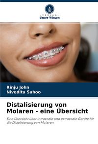 Produktbild: Distalisierung von Molaren - eine &Uuml;bersicht