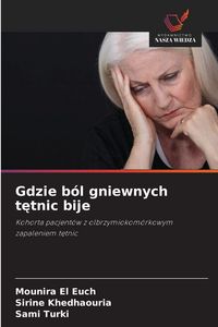Produktbild: Gdzie b&oacute;l gniewnych t&iquest;tnic bije