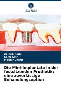 Produktbild: Die Mini-Implantate in der festsitzenden Prothetik: eine zuverl&auml;ssige Behandlungsoption