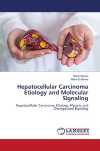 Produktbild: Hepatocellular Carcinoma Etiology and Molecular Signaling