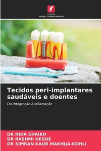 Produktbild: Tecidos peri-implantares saud&aacute;veis e doentes