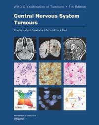 Produktbild: Central Nervous System Tumours